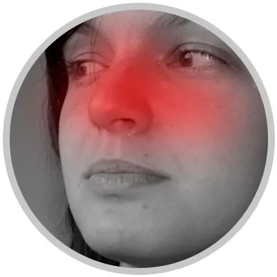Diagram showing congestion in the sinus passages.